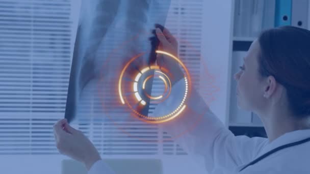 Röntgen Fotoğrafını Tutan Kadın Doktoru Tarayan Bir Animasyon Küresel Tıp — Stok video