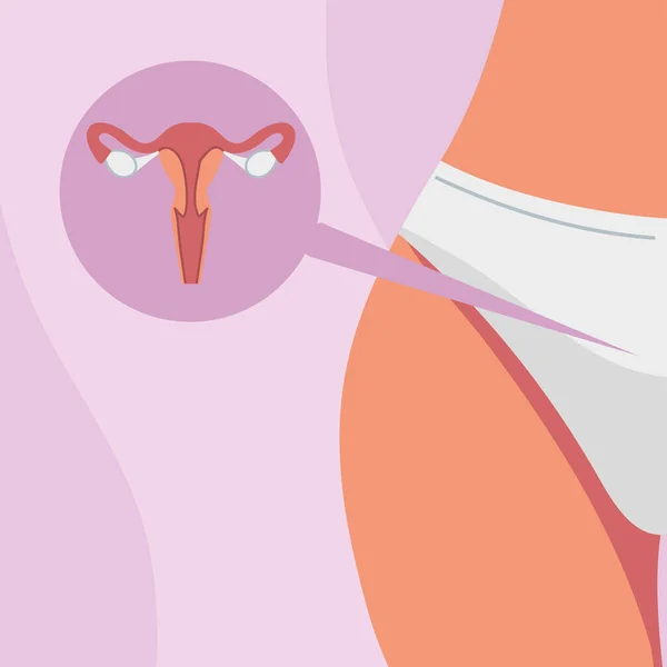 Gynecology uterus body — Stock Vector