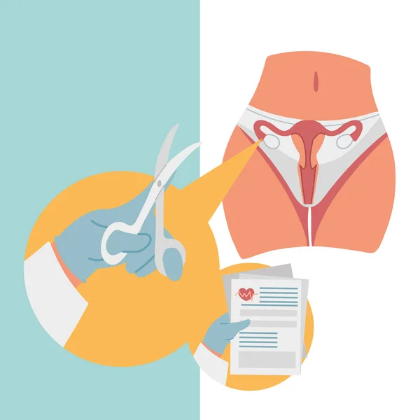 Gynecological surgery uterus — Stock Vector