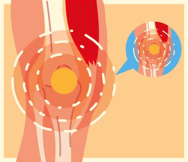 Romatoloji bacak ağrısı.