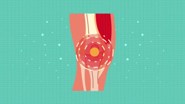 Animation zur rheumatologischen Knieschmerz-Erkrankung — Stockvideo