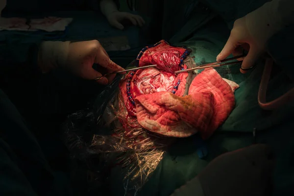 Die Intraoperative Gehirnchirurgie — Stockfoto