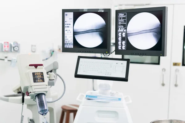Технология Эндоваскулярной Хирургии — стоковое фото