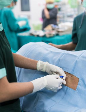 Doktor musun spinal sinir bloğu