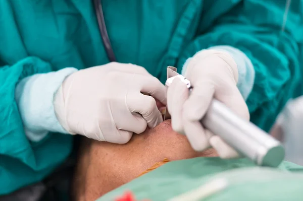 Aplicar lâmina de laringoscópio para inserir tubo endotraqueal — Fotografia de Stock