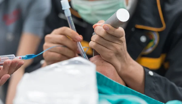 Intubate τραχειοσωλήνα — Φωτογραφία Αρχείου