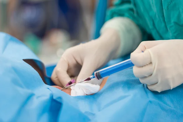 İç karotis damarı ponksiyon