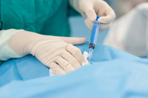 İç karotis damarı ponksiyon