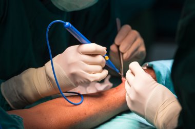 Surgeon make skin incision clipart