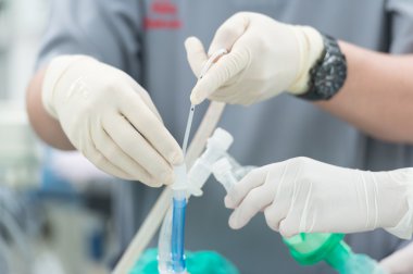 Anesthesia nurse use suction suck sputum in double lumen endotrachal clipart