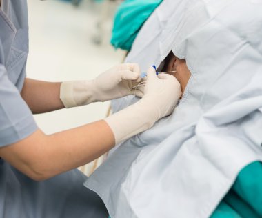 Epidural Analjezi