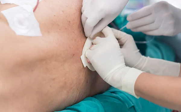 Epidural kateter düzeltmek