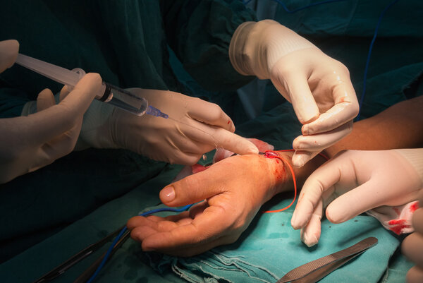 Arteriovenous fistula operation for dialysis