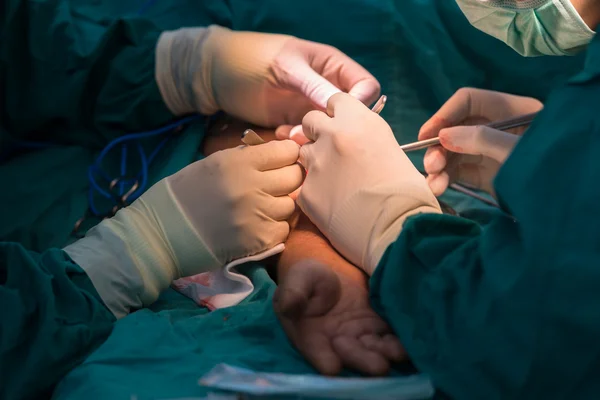 Equipo de cirugía opera fístula arteriovenosa —  Fotos de Stock