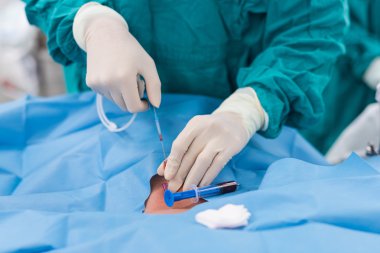 Doktor Uygulama Kılavuzu için iç karotis damarı