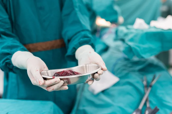 Хирург показывает образец легких после операции — стоковое фото
