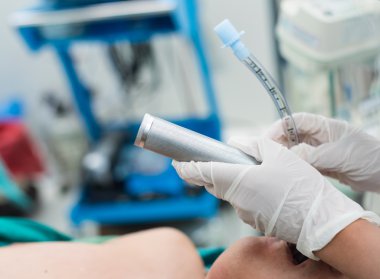 Endotrakeal tüp takın