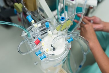 perfusionist kalp akciğer bypass hazırlamak 