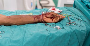 pucture arter endovasküler müdahale için