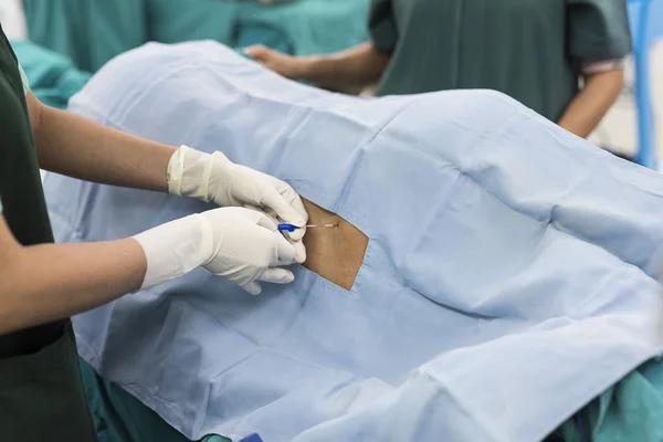 Epidural Nerve Block — Stock Photo, Image