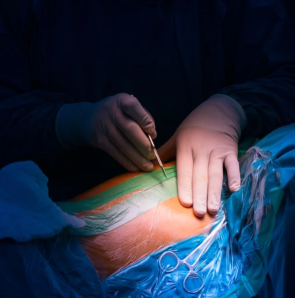 Хирург Делает Операцию — стоковое фото