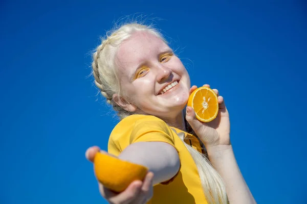 青空に対して、若いアルビノの女性はカメラにオレンジのスライスを保持します。. — ストック写真