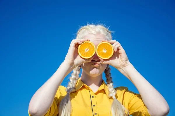 Genç bir albino kadın mavi gökyüzüne karşı portakal dilimleri tutuyor..