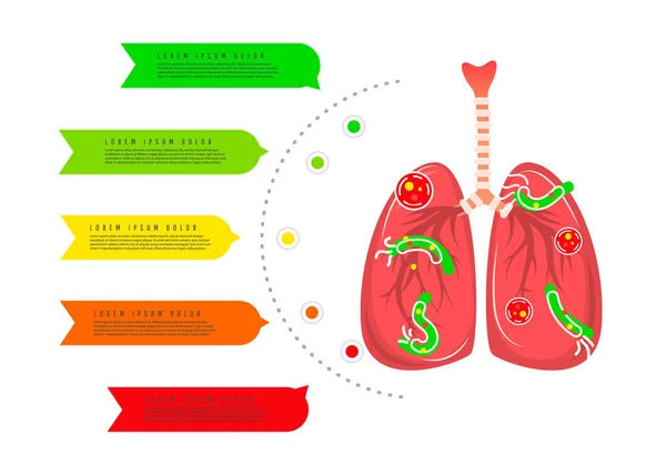 Los pulmones humanos son afectados por gérmenes y parásitos, infografías de cáncer de pulmón aisladas sobre fondo blanco. Día mundial de la tuberculosis — Vector de stock