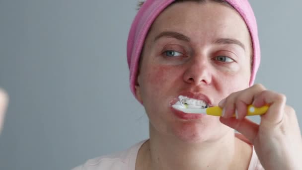 Jonge vrouw met een verband op haar hoofd reinigt haar tanden met een plastic tandenborstel in de badkamer. Ochtendgezondheidszorg — Stockvideo
