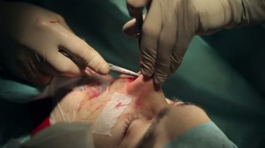 Ağız ve çene cerrahisi. Cerrah yüz kontur yapar