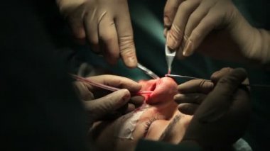 Ağız ve çene cerrahisi. Cerrah yüz kontur yapar