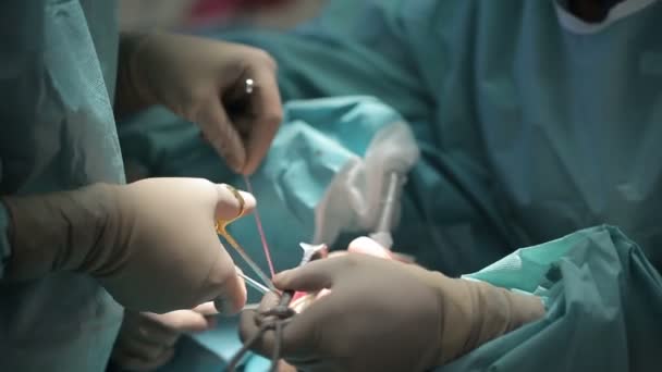 Oral and Maxillofacial Surgery. The surgeon makes facial contour — Stock Video