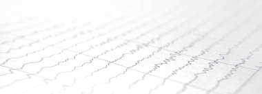 Kalp kardiyogramı olan bir kart..