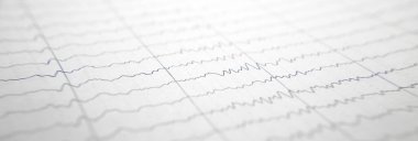 Kalp kardiyogramı olan bir kart..