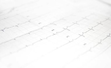 Kalp kardiyogramı olan bir kart..