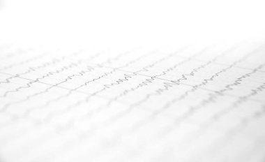 Kalp kardiyogramı olan bir kart..