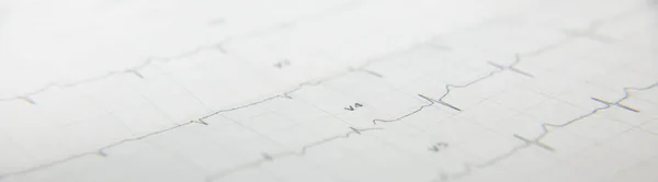 Kartu s kardiogramem srdce. — Stock fotografie