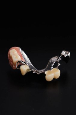 Siyah arkaplanda diş aletleri ve takma dişler var..