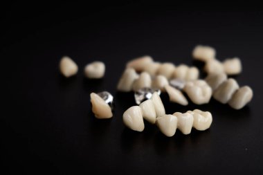 Siyah arkaplanda diş aletleri ve takma dişler var..