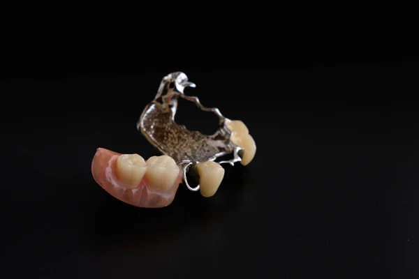 Urządzenia Dentystyczne Protezy Dentystyczne Czarnym Tle — Zdjęcie stockowe