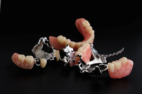 Aparatos Dentales Prótesis Dentales Sobre Fondo Negro —  Fotos de Stock