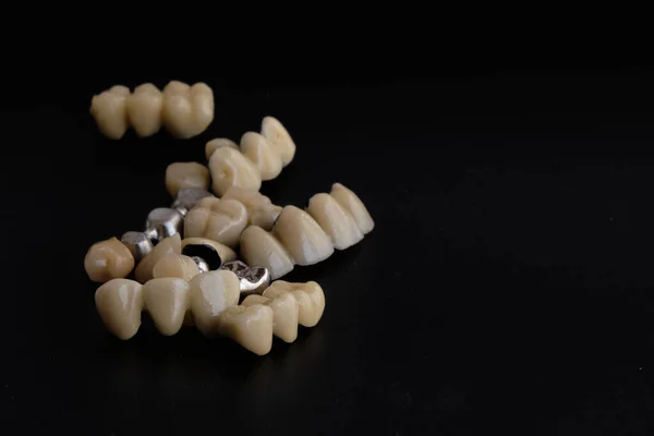 Aparatos Dentales Prótesis Dentales Sobre Fondo Negro —  Fotos de Stock