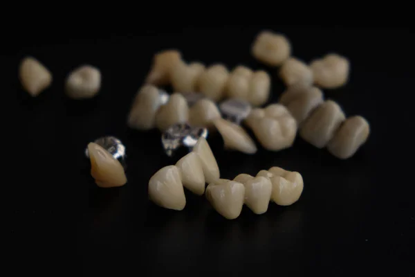 Urządzenia Dentystyczne Protezy Dentystyczne Czarnym Tle — Zdjęcie stockowe