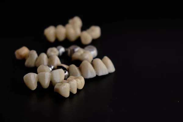 Zubní Spotřebiče Zubní Protézy Černém Pozadí — Stock fotografie