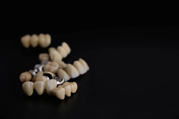 Zubní Spotřebiče Zubní Protézy Černém Pozadí — Stock fotografie