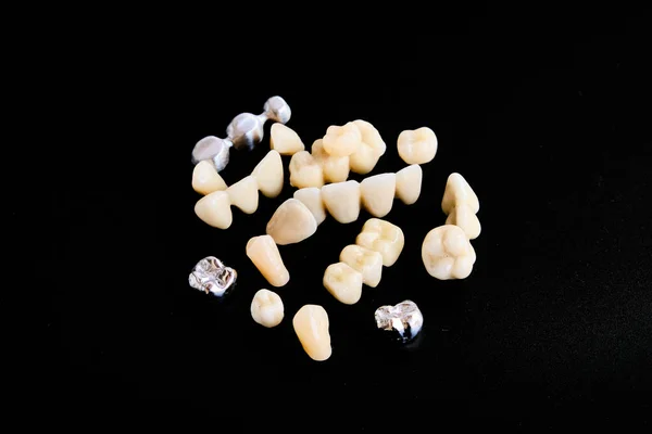 Aparelhos Dentários Próteses Sobre Fundo Preto — Fotografia de Stock