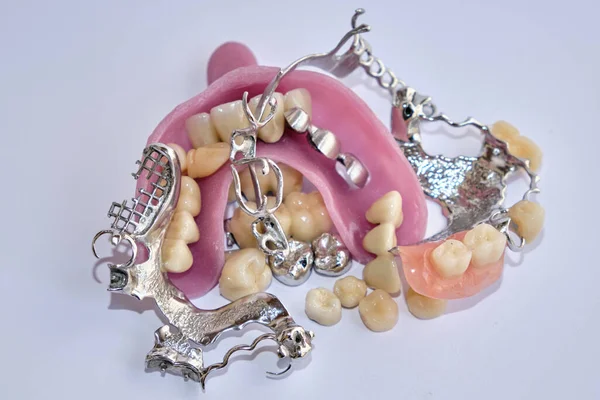 Aparatos Dentales Prótesis Dentales — Foto de Stock