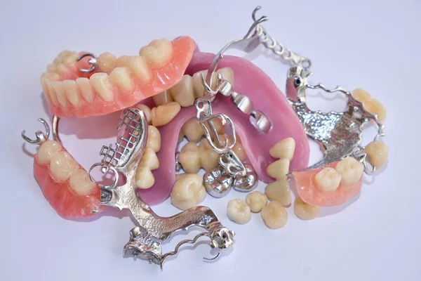 Urządzenia Dentystyczne Protezy Dentystyczne — Zdjęcie stockowe