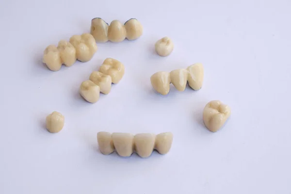 Aparatos Dentales Prótesis Dentales —  Fotos de Stock