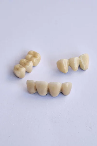 Aparelhos Dentários Próteses Dentárias — Fotografia de Stock